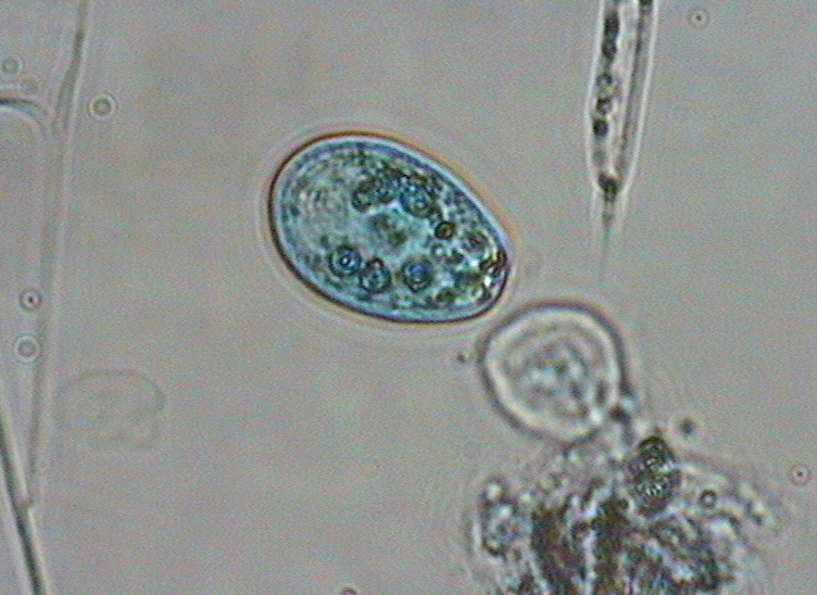 Dictyocha speculum
